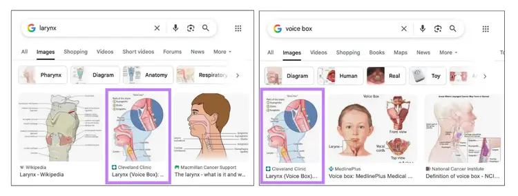 Image appears for both larynx and voice box search results.